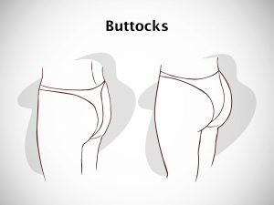 BUTTOCKS