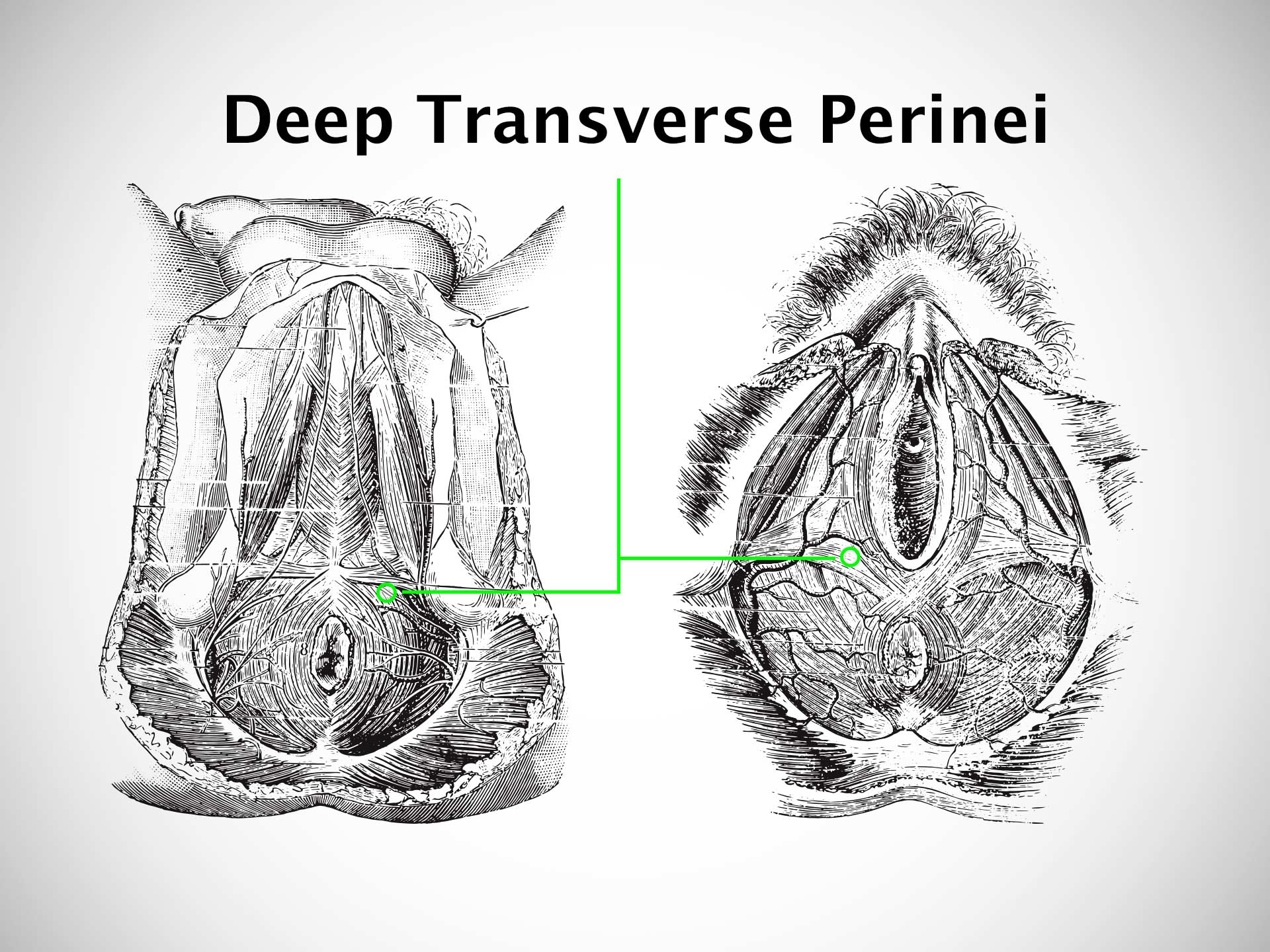 DEEP TRANSVERSE PERINEI