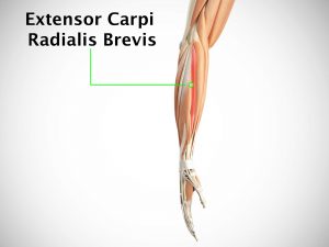 EXTENSOR CARPI RADIALIS BREVIS