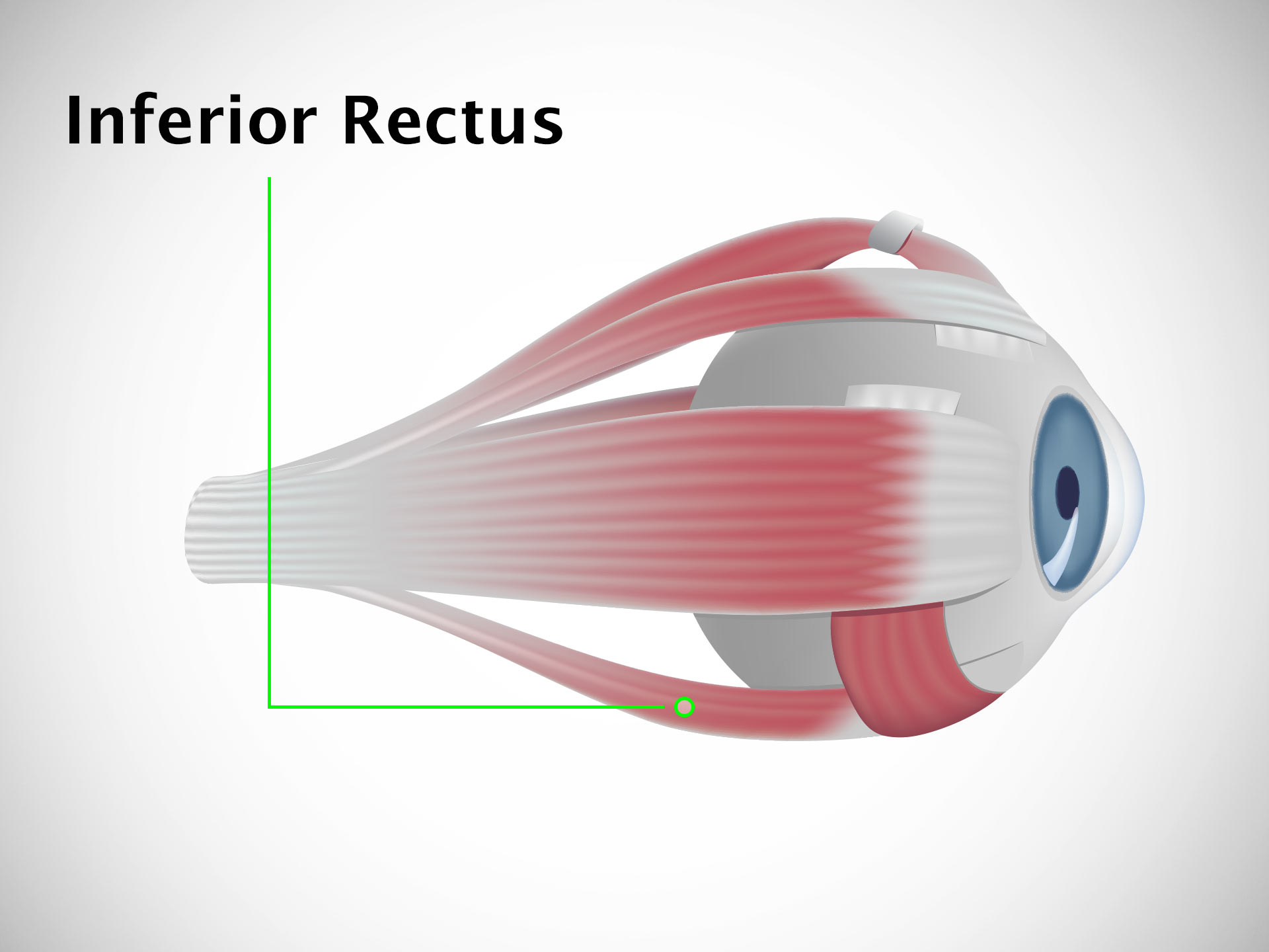 INFERIOR RECTUS