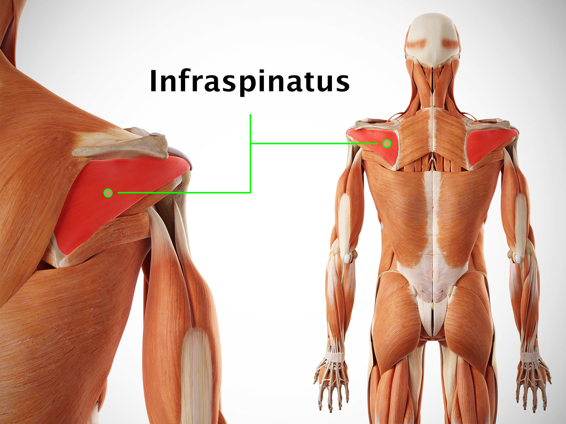 INFRASPINATUS