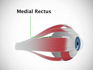 MEDIAL RECTUS