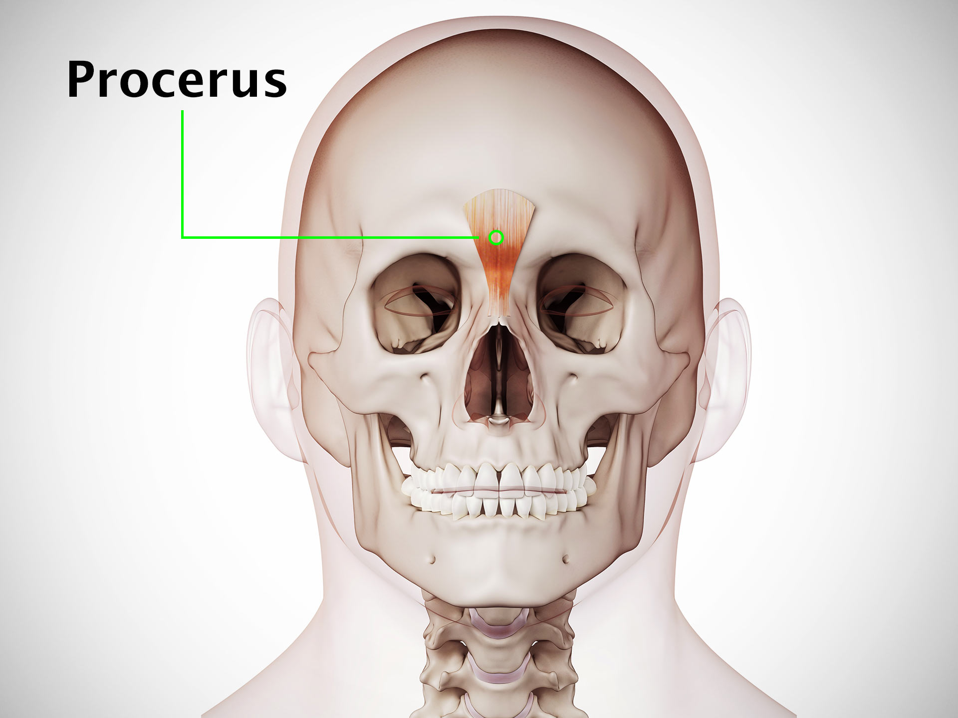 PROCERUS