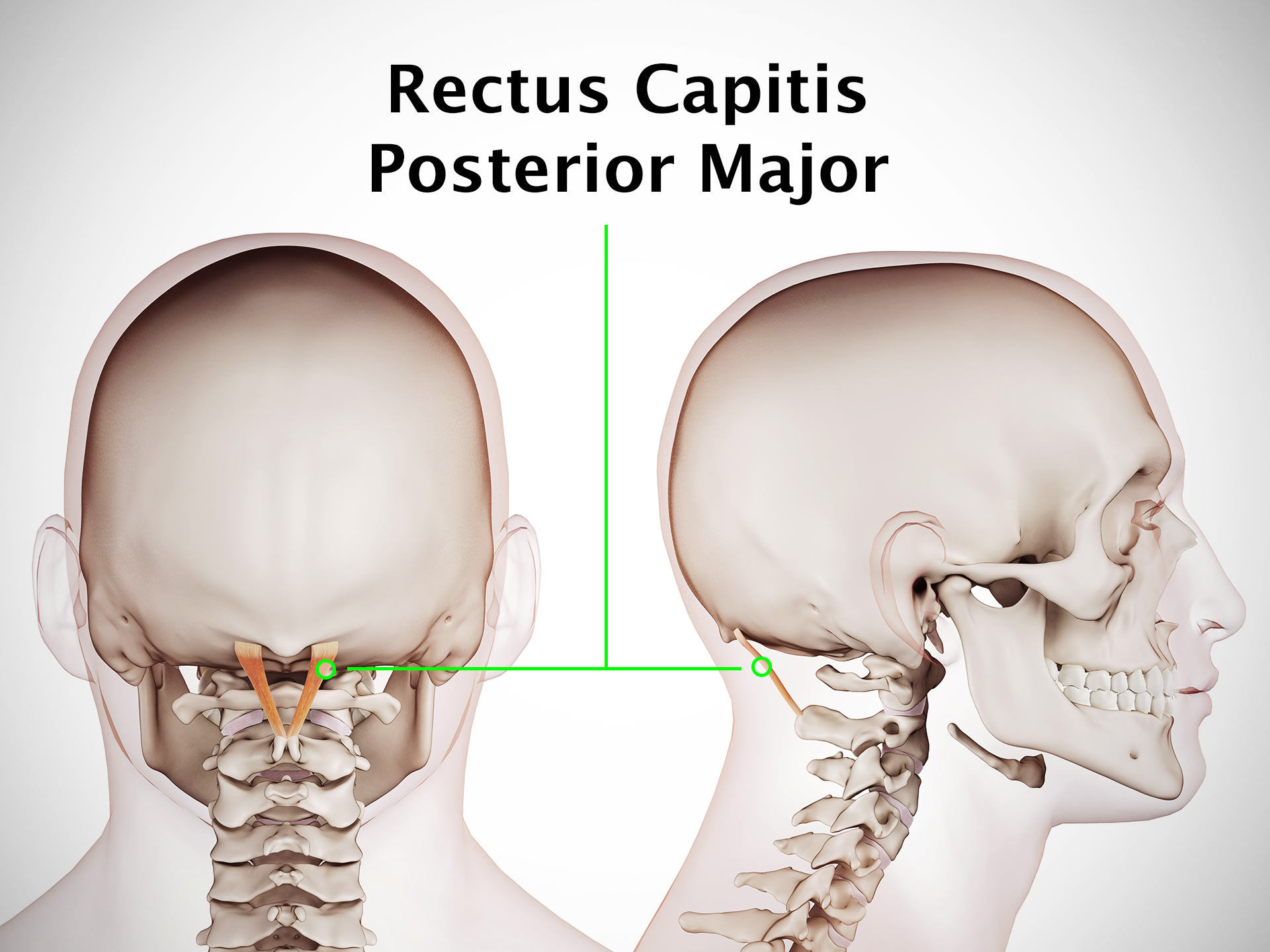 RECTUS CAPITIS POSTERIOR MAJOR