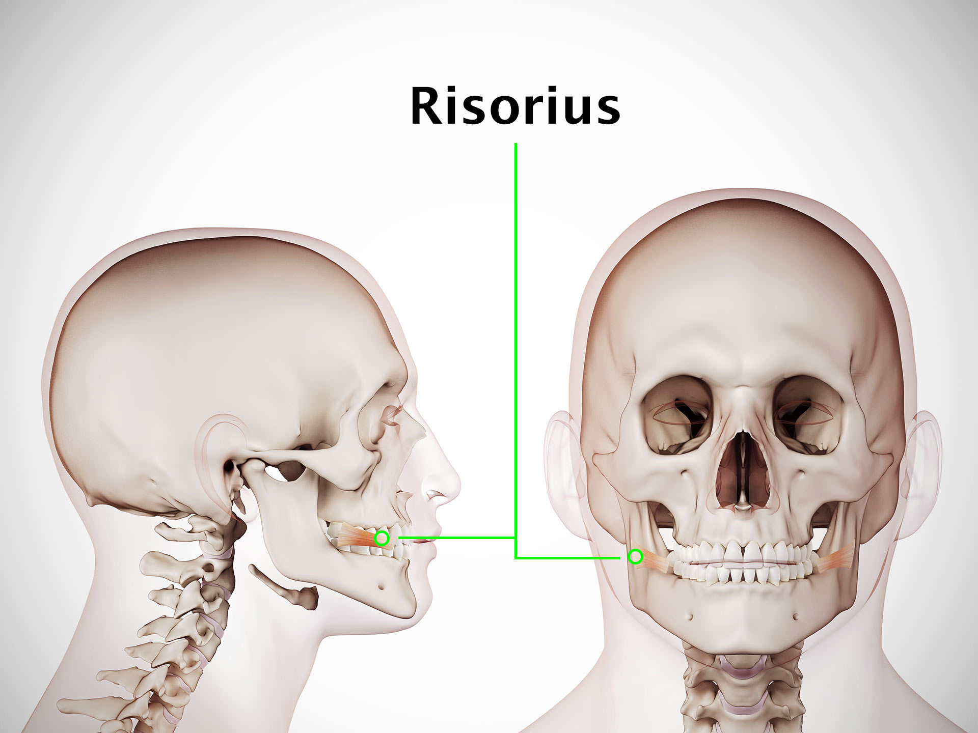 RISORIUS