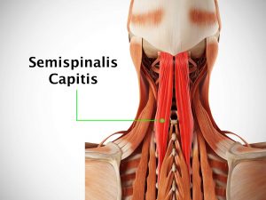 SEMISPINALIS CAPITIS