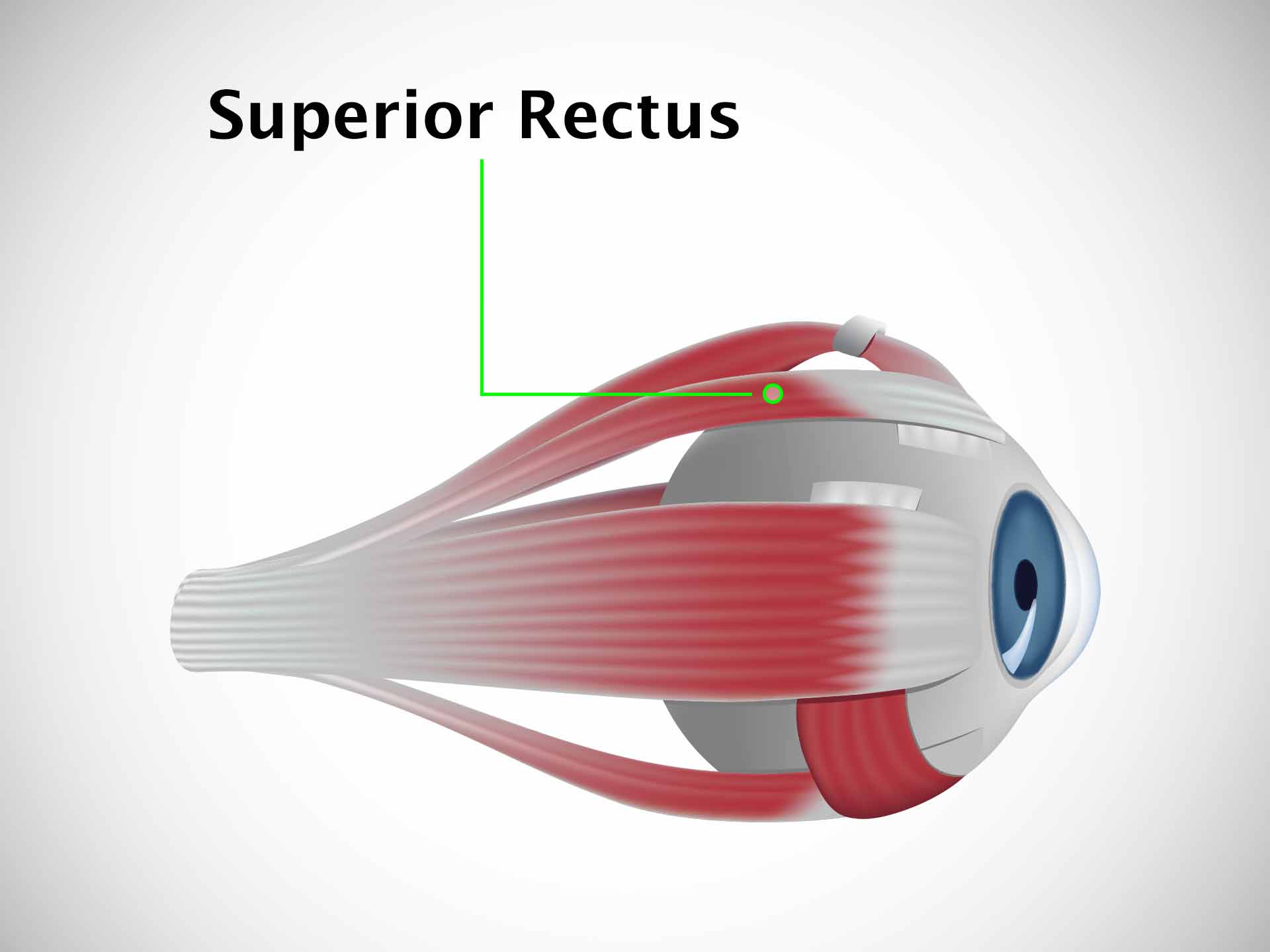 SUPERIOR RECTUS