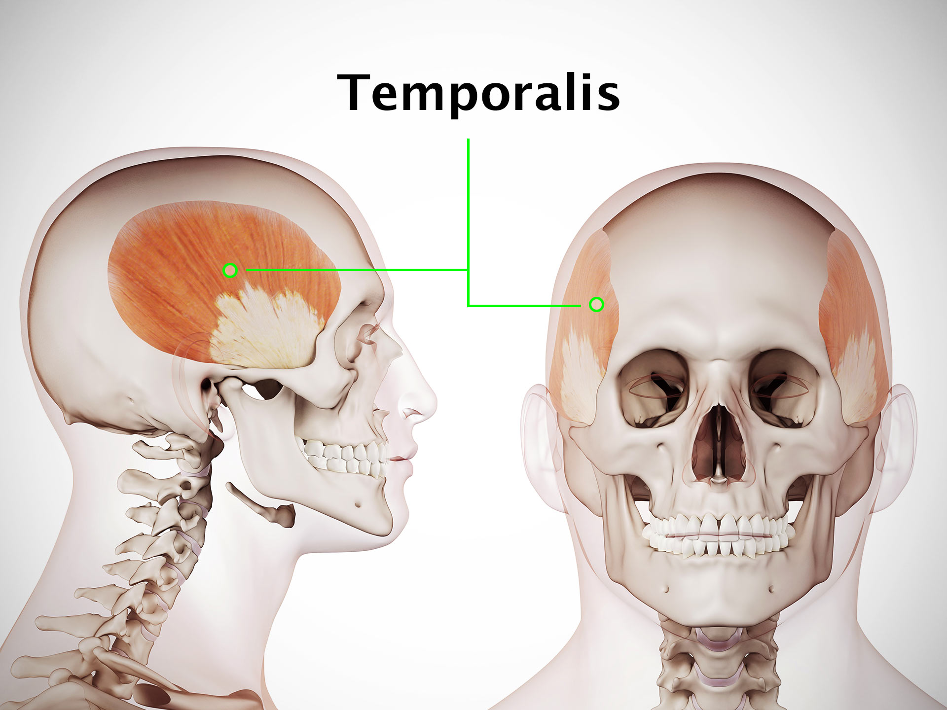 TEMPORALIS