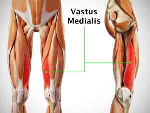 VASTUS MEDIALIS