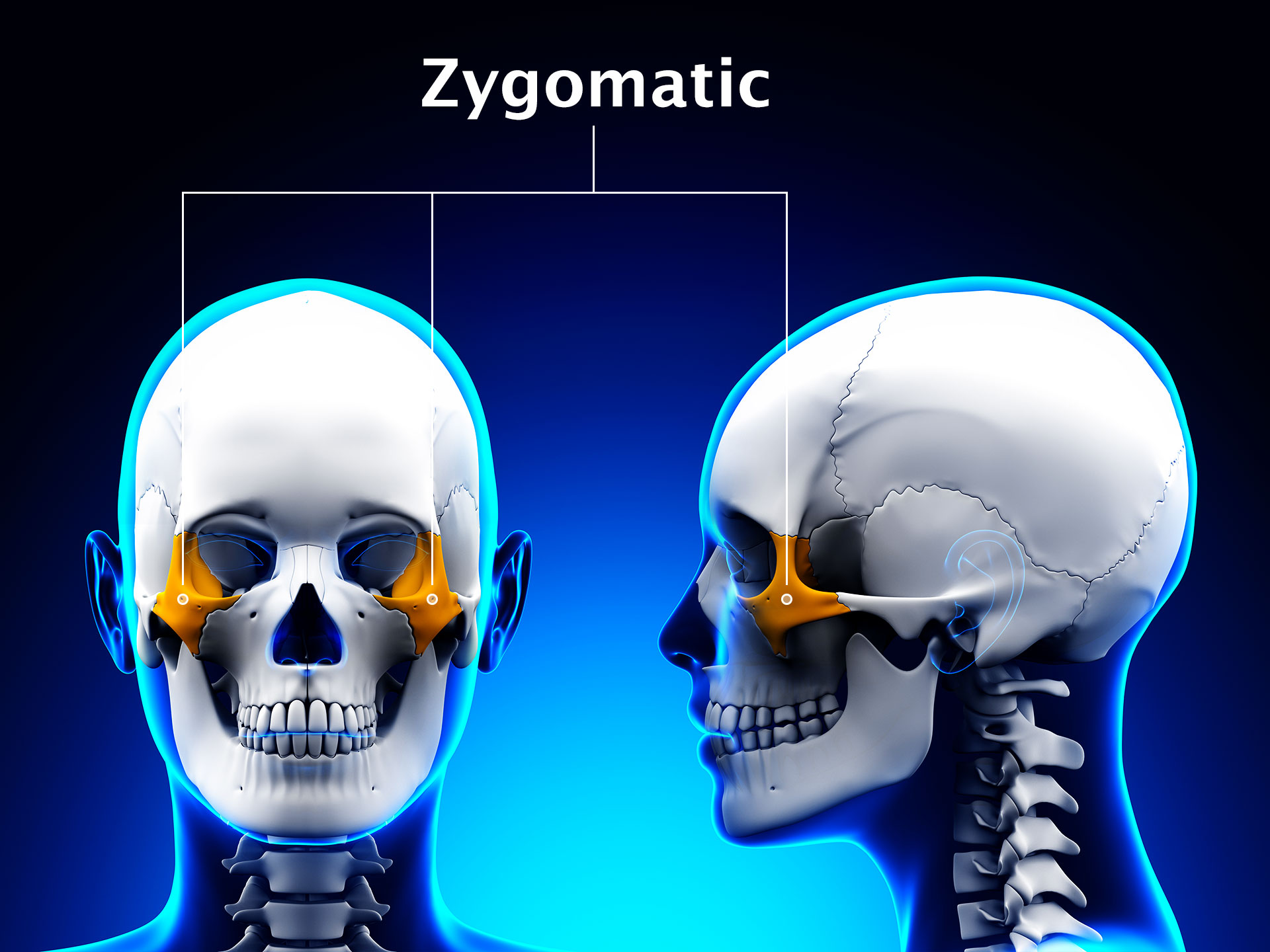 ZYGOMATIC BONE