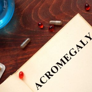 Acromegaly