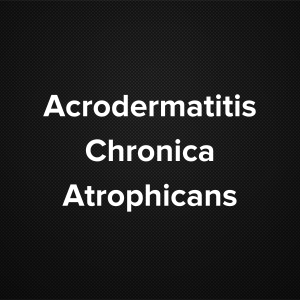 Acrodermatitis Chronica Atrophicans