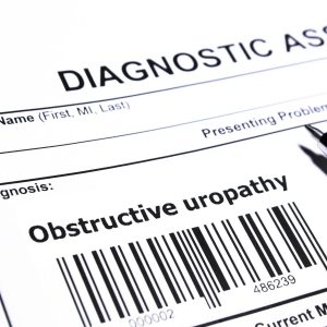 Acute Bilateral Obstructive Uropathy