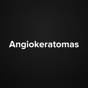 Angiokeratomas