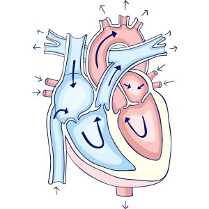 Aortic valve regurgitation (Aortic insufficiency)