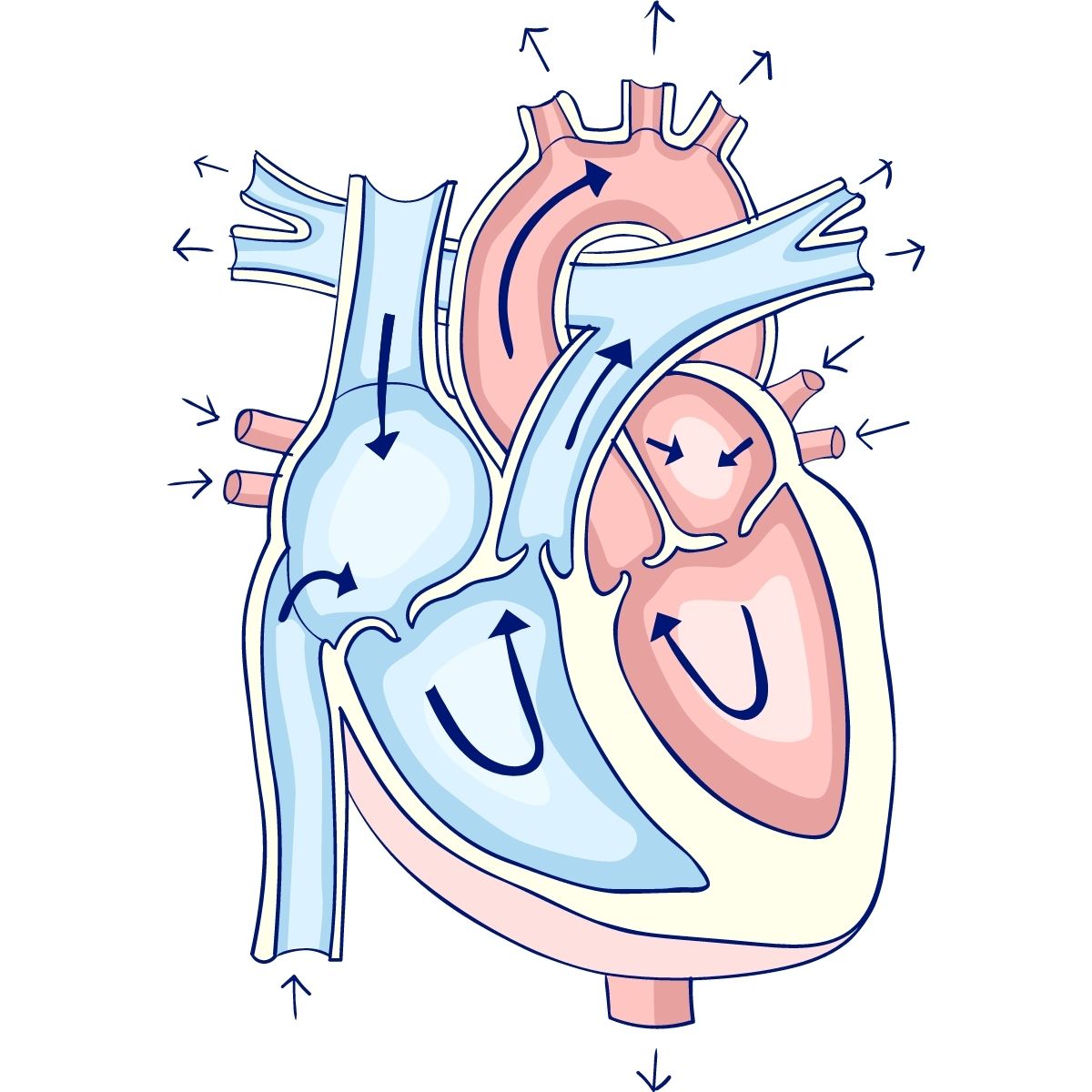 Aortic valve regurgitation (Aortic insufficiency)