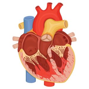 Atrial septal defect