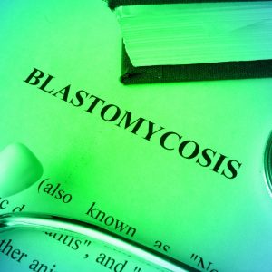 Blastomycosis