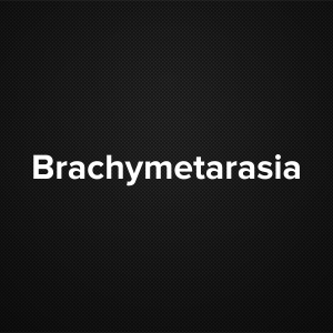 Brachymetatarsia