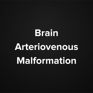 Brain Arteriovenous malformation