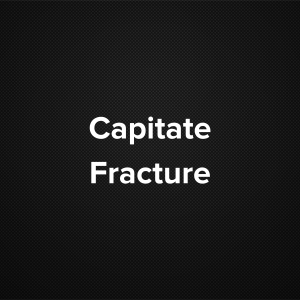 Capitate Fracture