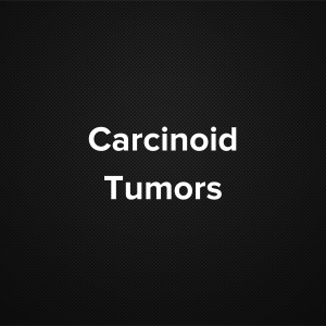 Carcinoid tumors