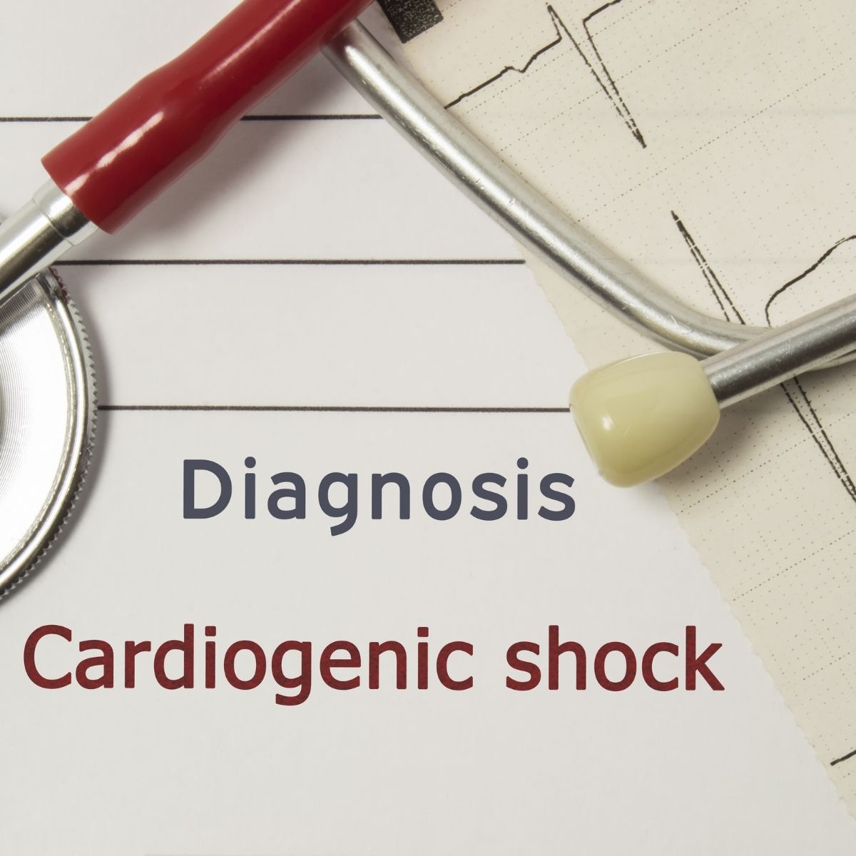 Cardiogenic shock