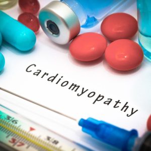 Cardiomyopathy