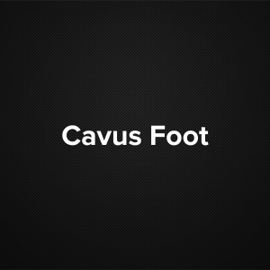 Cavus foot
