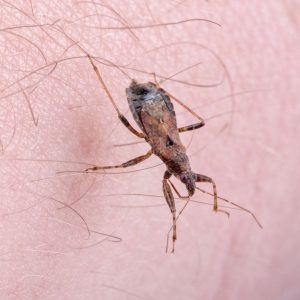 Chagas disease