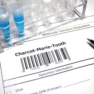Charcot–Marie–Tooth Disease