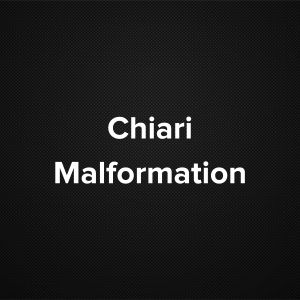 Chiari malformation