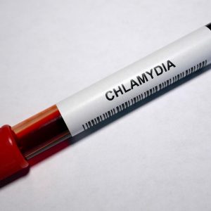 Chlamydia Infection