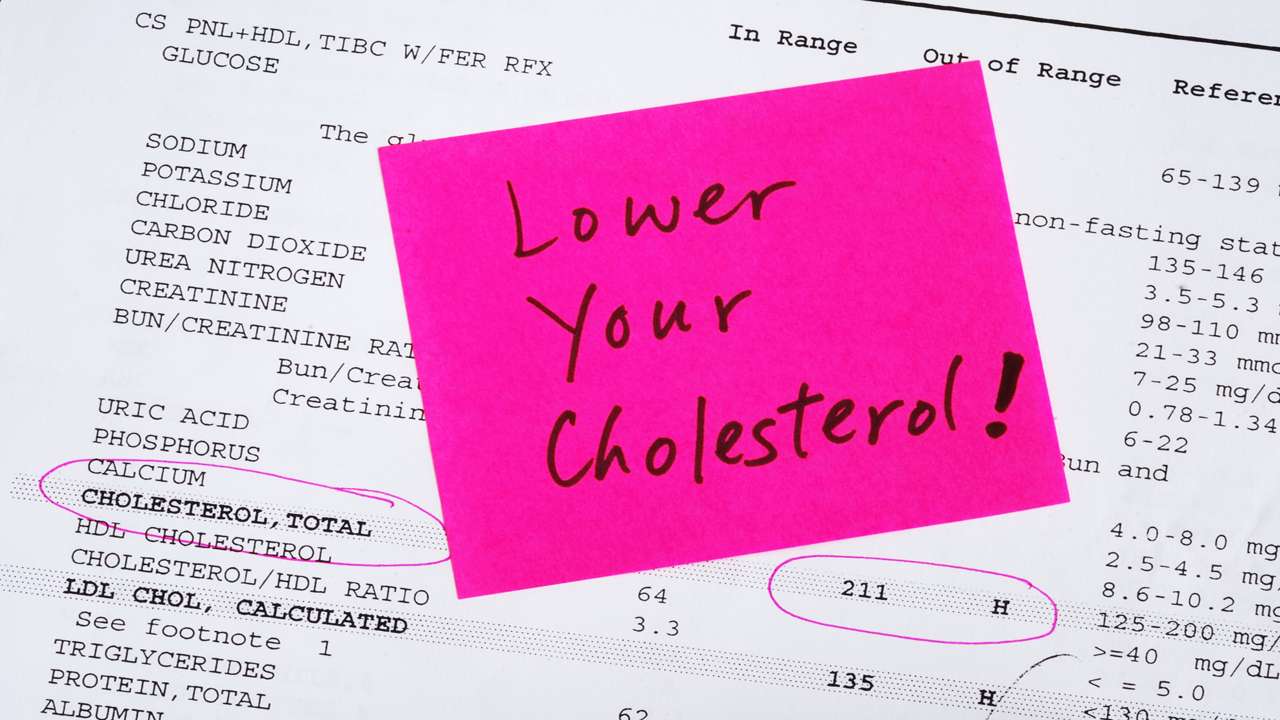 Cholesterol – Good or Bad ?