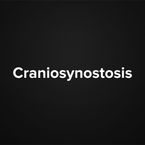 Craniosynostosis