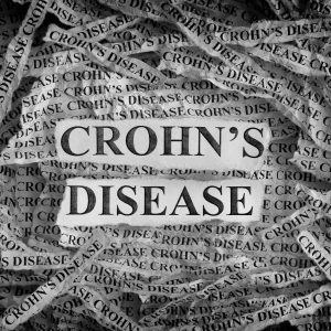 Crohns disease