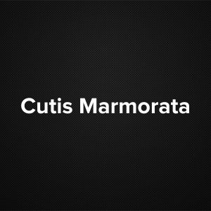 Cutis Marmorata