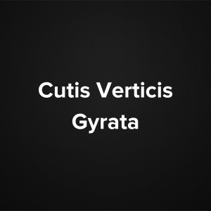 Cutis Verticis Gyrata