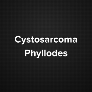 Cystosarcoma phyllodes