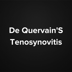 De Quervain’s Tenosynovitis