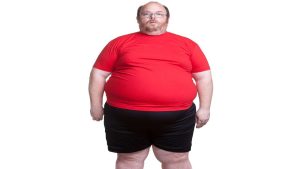 Dealing with extreme obesity