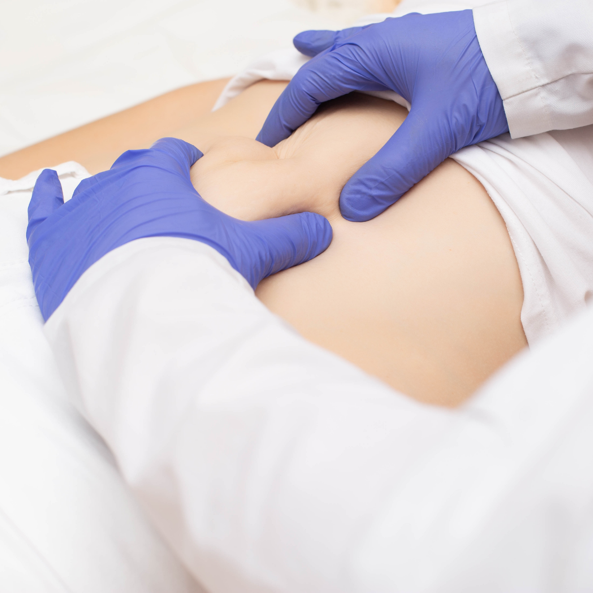 Diaphragmatic hernia