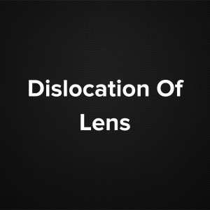 Dislocation of Lens