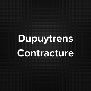 Dupuytrens Contracture