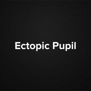 Ectopic Pupil