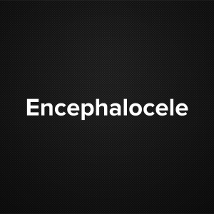 Encephalocele
