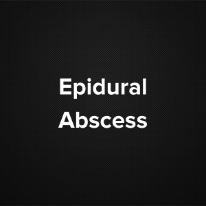 Epidural Abscess