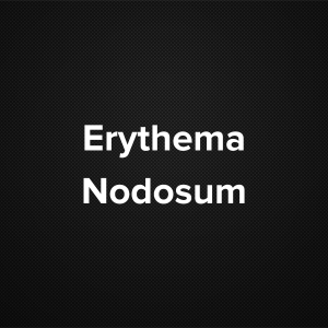 Erythema Nodosum