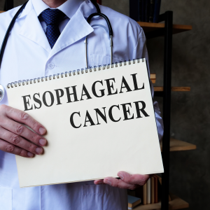 Esophageal cancer