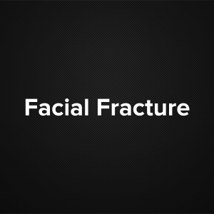 Facial Fracture